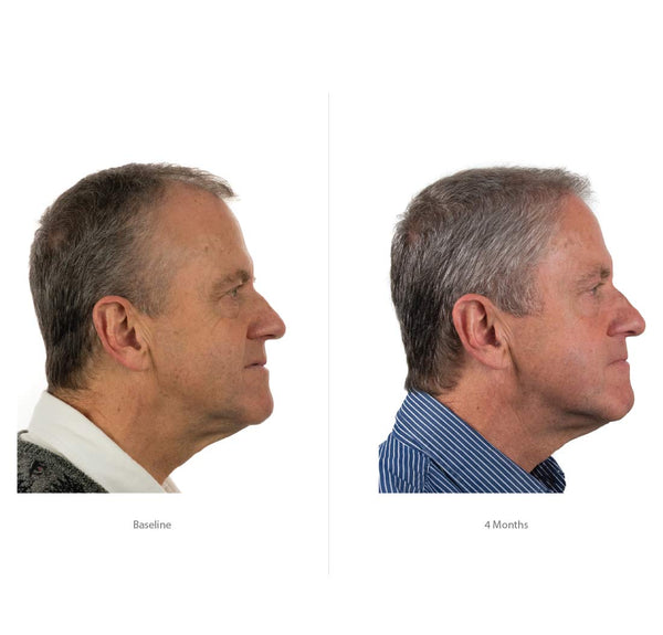 FOLIGAIN Triple Action Conditioner For Thinning Hair For Men with 2% Trioxidil 473ml - FOLIGAIN EUROPE