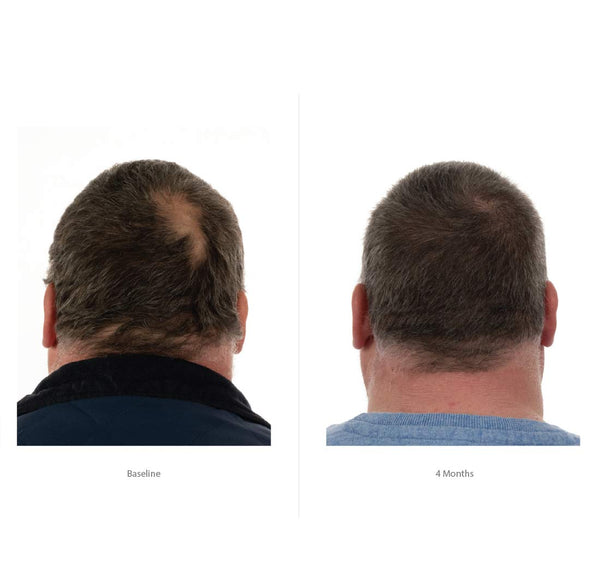 Șampon FOLIGAIN cu triplă acțiune pentru păr subțire pentru bărbați cu 2% trioxidil 473 ml
