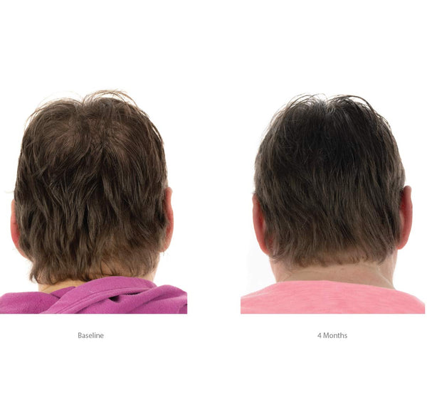 Balsam cu triplă acțiune FOLIGAIN pentru păr subțire pentru femei cu 2% trioxidil 473 ml