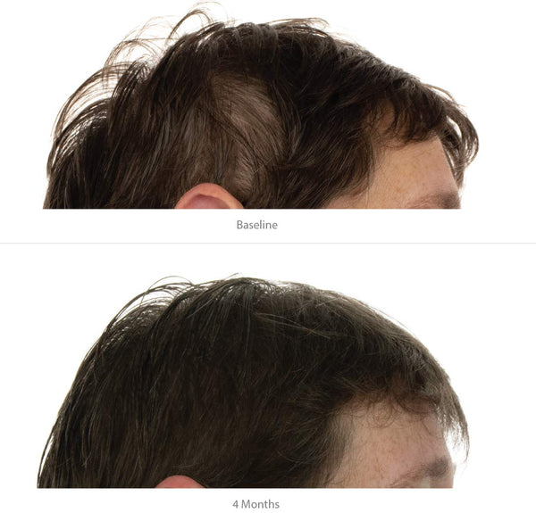Balsam cu triplă acțiune FOLIGAIN pentru păr subțire pentru femei cu 2% trioxidil 473 ml